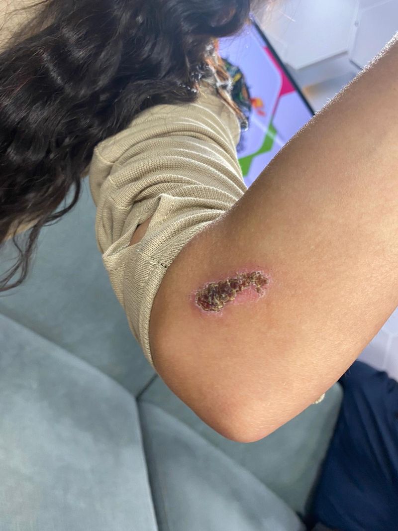 Irisha, răni după Survivor