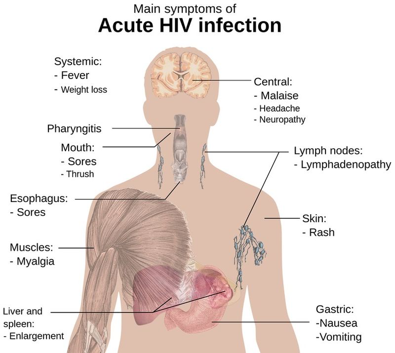 Pandemia COVID i-a făcut pe cetățeni să neglijeze situația HIV în România! Rata de testare a scăzut semnificativ, numărul infectărilor a crescut 