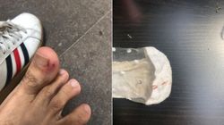 Invazia șobolanilor în București! Un tânăr de 26 de ani a fost mușcat de o răzătoare în centrul Capitalei