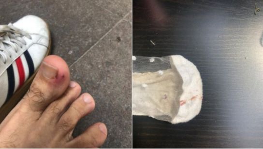 T&acirc;năr, mușcat de un șobolan &icirc;n Capitală