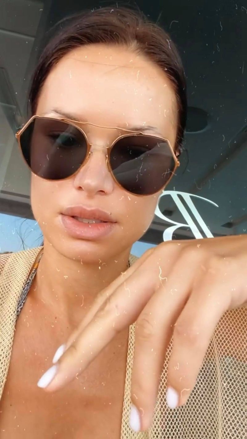 Irisha, a doua zi după ce a fost mușcată de albină