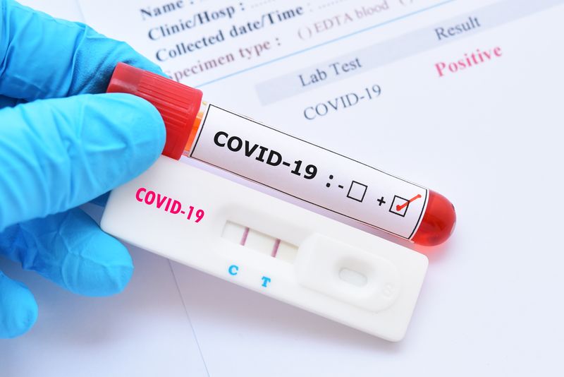 Lista farmaciilor unde te poți testa gratuit pentru COVID-19