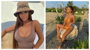 Andra Voloș a dezvăluit cum arăta înainte de operațiile estetice