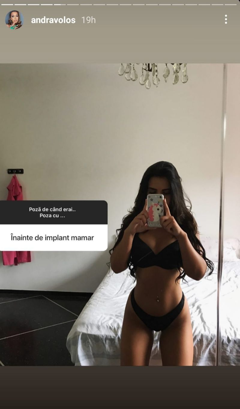 Cum arăta Andra Voloș &icirc;nainte să &icirc;și pună implant mamar?