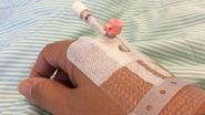 Femeia a fost diagnosticată cu criză biliară, însă medicii s-au răzgândit în privința unei intervenții chrirugicale