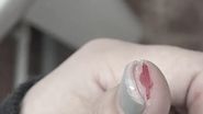 În urma gestului necugetat al profesoarelor, elevele s-au ales cu răni la degete