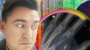 Ce face microcipul pe care George Buhnici și l-a implantat în mână: „Am o capsulă de dimensiunea unui bob de grâu între două degete de la mână”