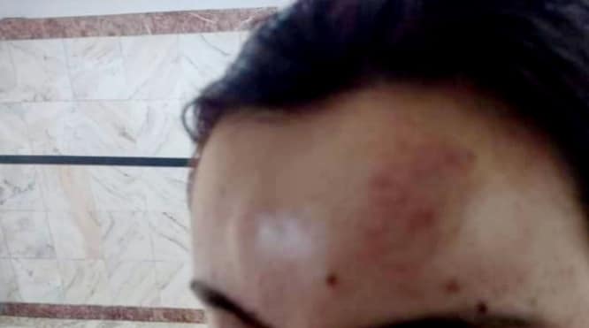 Un patron de restaurant din Alexandria a bătut-o pe angajata sa 