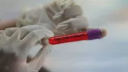  Omicron supravieţuieşte mai mult pe plastic şi pe piele decât variantele anterioare