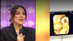 Primele imagini cu ecografia bebelușul Ancăi Ciota!