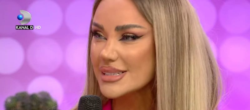 Bianca Drăgușanu a trecut recent printr-o intervenție de micșorare a buzelor