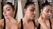 Andreea Mantea,  noi probleme cu tenul