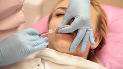 Care este diferența dintre acid hialuronic și botox și de ce se crează confuzie între cele două substanțe