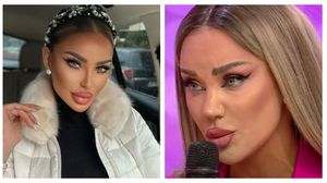 După ce a dezvăluit că regretă, Bianca Drăgușanu și-a injectat din nou acid în buze! Cum arată acum: „Încerc să le remodelez”