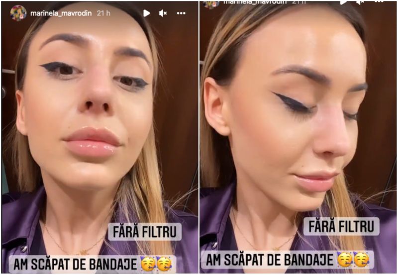 Marinela Mavrodin, plină de vânătăi și bandaje pe față!