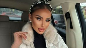 Bianca Drăgușanu a apelat, din nou, la ajutorul medicului estetician! Blondina a intervenit la nivelul mânilor: „Frumusețea presupune anumite sacrificii”