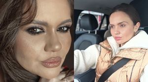 Cristina Șișcanu, adevărul despre operațiile estetice!  Și-a mărit sau nu buzele