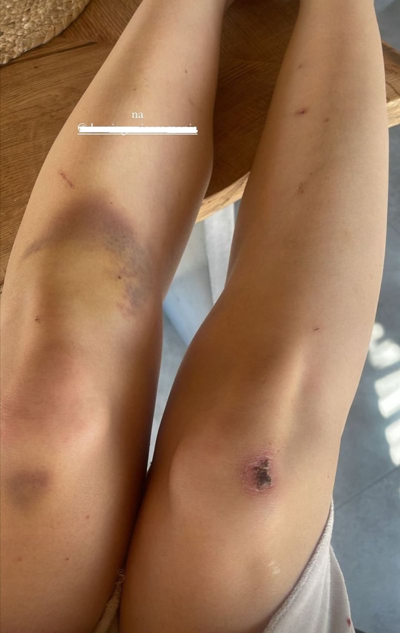 Carmen Grebenișan s-a fotografiat plină de v&acirc;nătăi