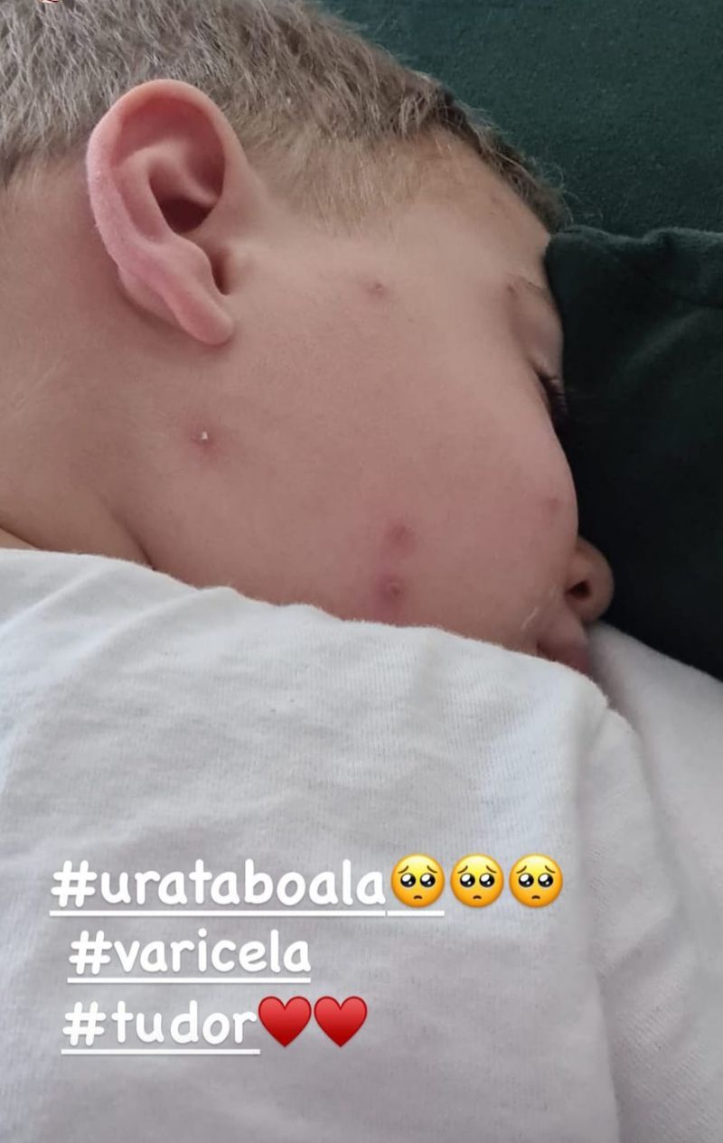 Tudor, fiul cel mic al Mirelei Vaida, are varicelă