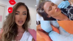 „Pacientul este pregătit, iar acum urmează injectarea” Bianca Drăgușanu nu mai e pacient, acum e medic estetician! Prima pacientă, chiar sora sa, Oana
