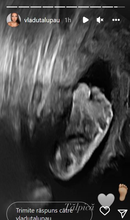 Prima imagine cu băiețelul Vlăduței Lupău! Ce s-a văzut, atunci când artista a postat fotografia