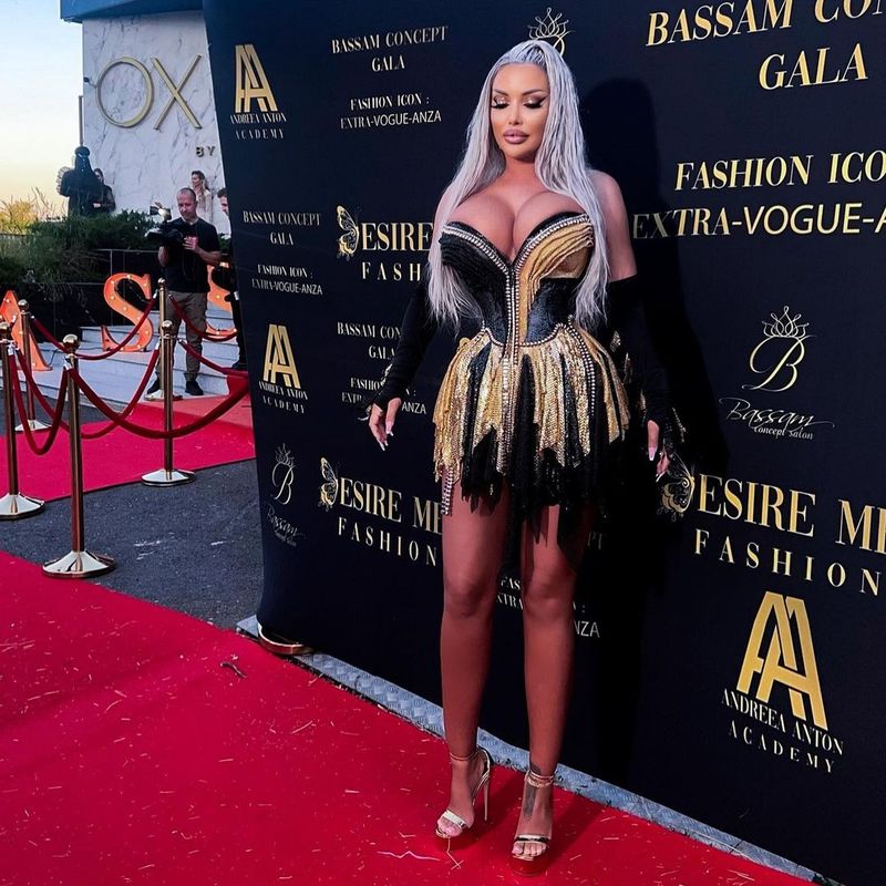 „Arăți ca un babuin” Loredana Chivu, atacată de fani din cauza kilogramelor în plus. De ce boală suferă dansatoarea