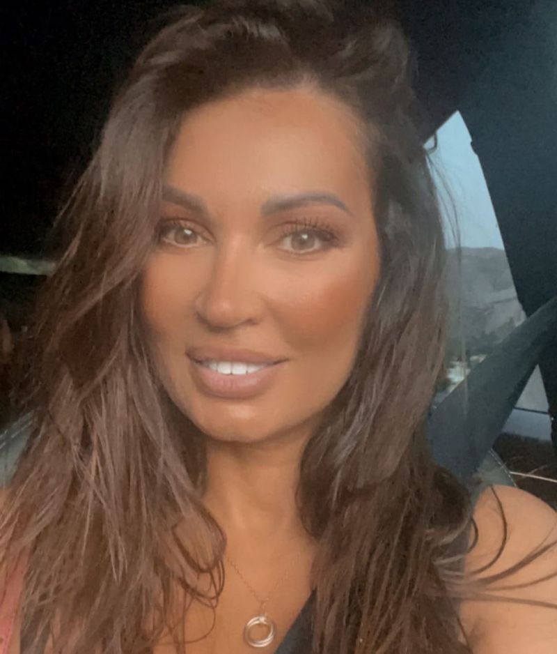 Nicoleta Luciu suferă de alopecie