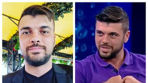 Cum a reușit Marius Elisei, Iubitul Oanei Roman, să se vindece de alopecie? A apelat la toate variantele pentru a scăpa de boală