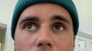 Justin Bieber, cu jumătate de față paralizată
