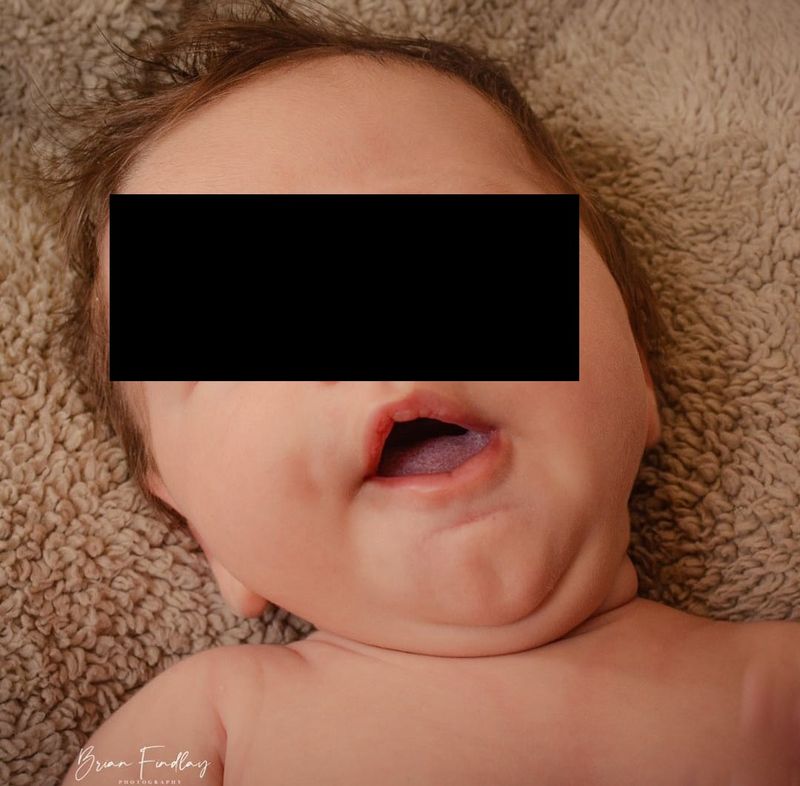 Bebeluș gigant la naștere