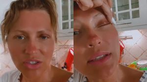 Ce a pățit Mirela Vaida, după prima vacanță în Delta Dunării: „Nu știu ce să fac, să mă operez?!”