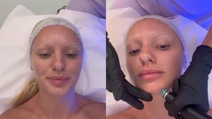 Alexandra Stan, din nou în cabinetul medicului! Ce schimbări și-a făcut artista „În sfârșit am ajuns pe patul meu preferat”
