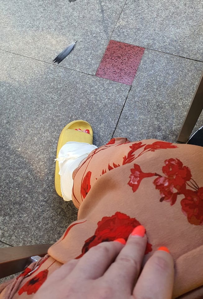 oana lis, viorel lis, oana lis la spital, oana lis picior rupt