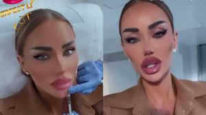 Bianca Drăgușanu, oprită de medic să-și mai mărească buzele. Diva nu se mai poate abține să-și facă operații estetice