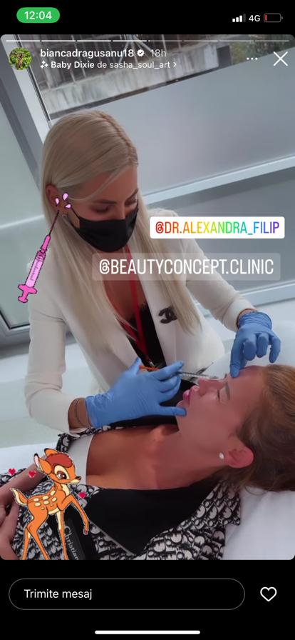 Bianca Drăgușanu, oprită de medic să-și mai mărească buzele. Diva nu se mai poate abține să-și facă operații estetice