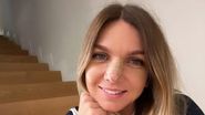 Simona Halep operație