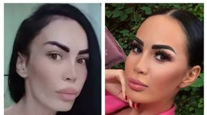 Bianca Pop se confruntă din nou cu probleme de sănătate! Bruneta a intrat în panică: „O mușcătură de șarpe”