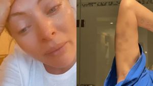 Delia a apărut plină de vânătăi  în fața fanilor ei. Ce s-a întâmplat cu artista cu puțin timp în urmă