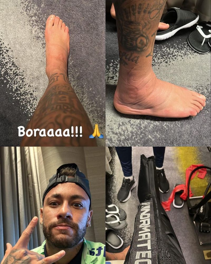 Neymar a decis să pună o serie de fotografii cu glezna umflată după accidentarea suferită la Cupa Mondială din Qatar