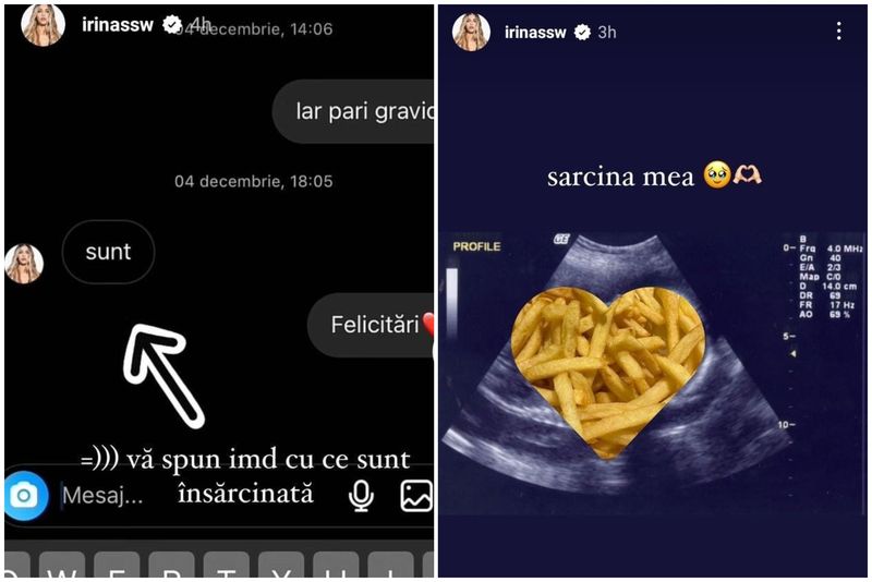 irina deaconescu, cristi manea, influencer, sarcină, ecografie