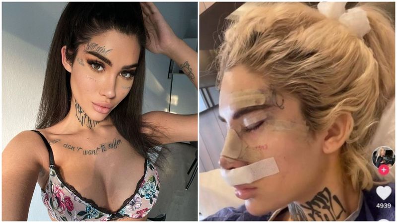 bia khalifa operatii estetice, bia khalifa medic estetician, bia rinoplastie