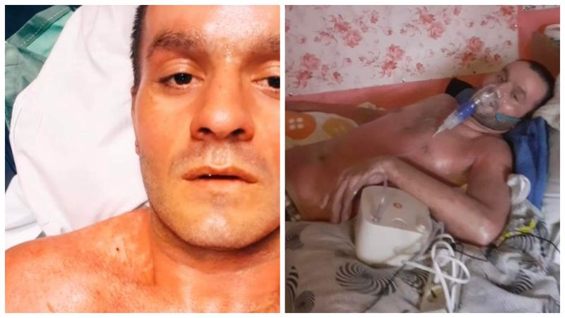 Florin, TikTokerul care și-a dat foc pe live în urmă cu două luni, a ieșit din comă! Apropiații tânărului, primele declarații: „Este un miracol”