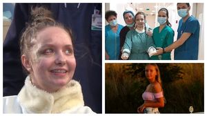 alexia, accident, pașcani, replatarea brațelor, medici