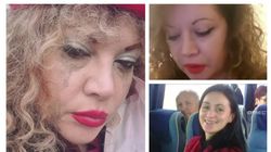 Oana Lis, la un pas să sfârșească la fel ca Ana Oroș! A fost atacată și mușcată de o haită de 20 de câini: „Eu am leșinat. Un vecin a văzut pe geam”