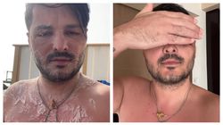 Liviu Vârciu, ultimele detalii despre starea de sănătate: „Acum s-a uscat pe față”. Ce i s-a întâmplat la scurt timp după ce a decis să folosească un leac băbesc