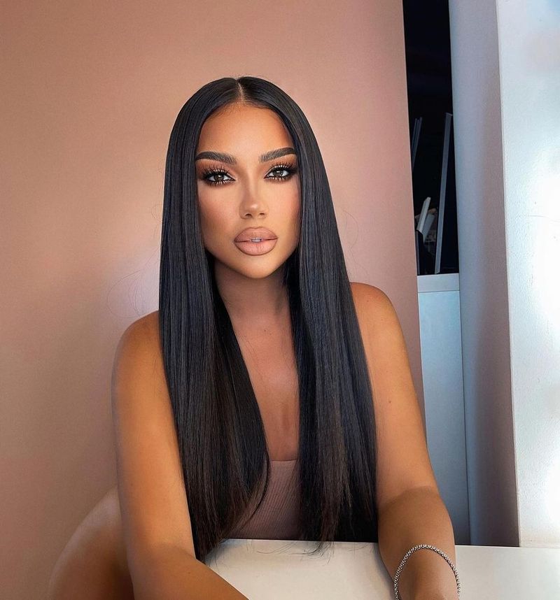 Larisa Udilă acid buze, Larisa Udilă operatii estetice, Larisa Udilă silicoane