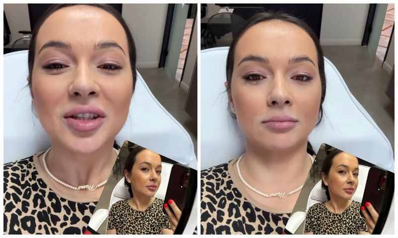 Vlăduța Lupău, intervenție estetica