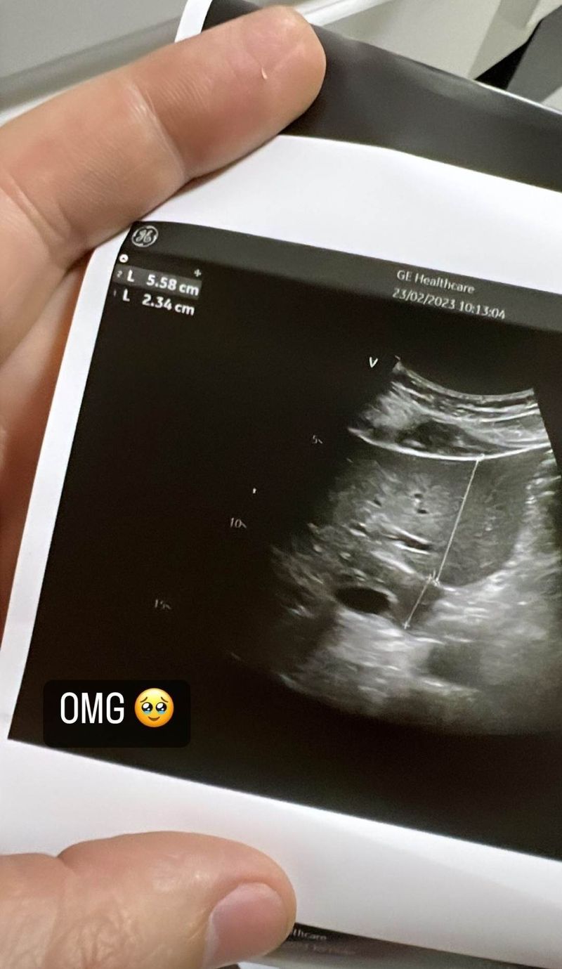 Florin Ristei, Naomi Hedman 