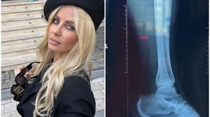 andreea bănică, artistă, probleme de sănătate, radiografuie, rețele de socializare
