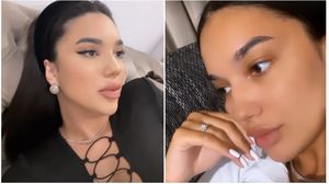 Larisa Udilă acid buze, Larisa Udilă operatii estetice, Larisa Udilă silicoane